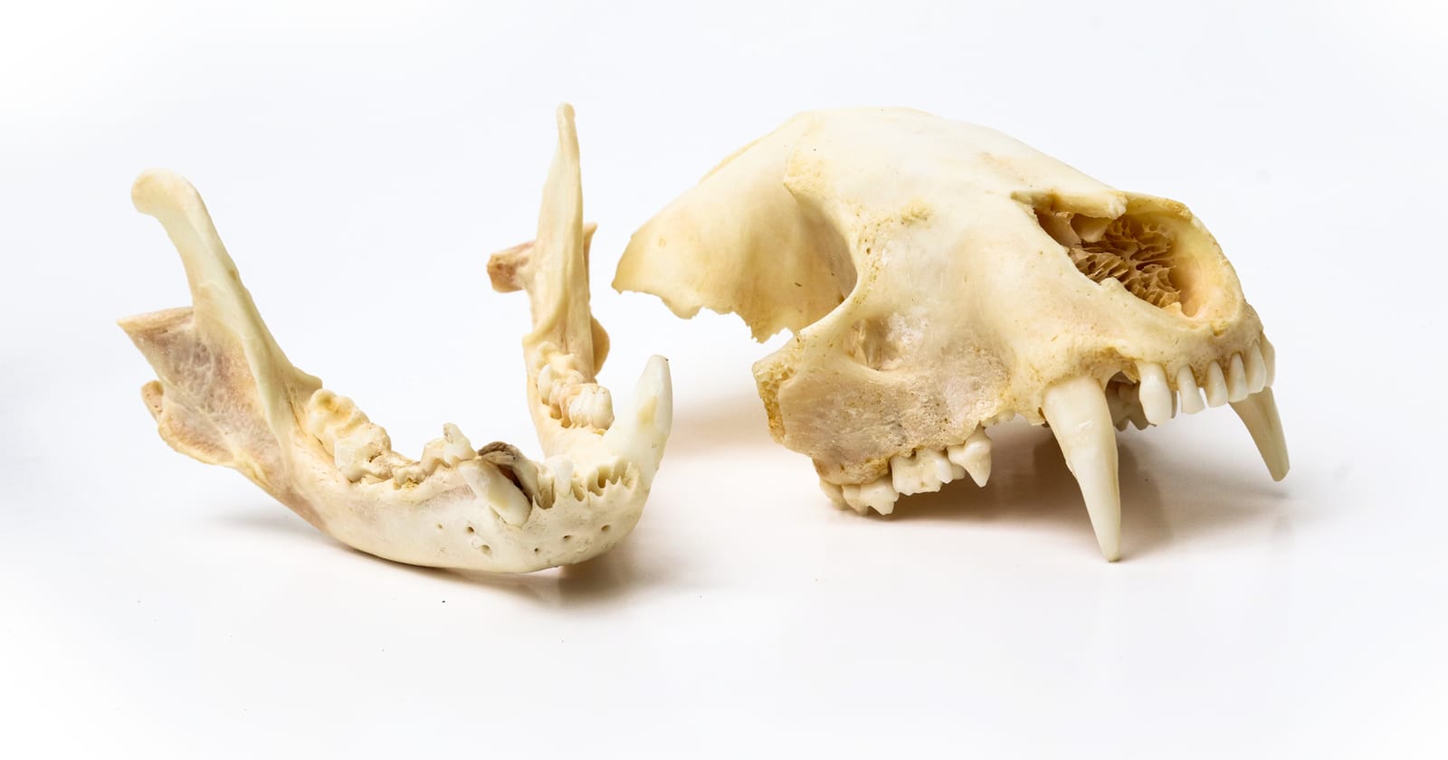 Bone Graft Dental: Restore Your Jaw & Smile