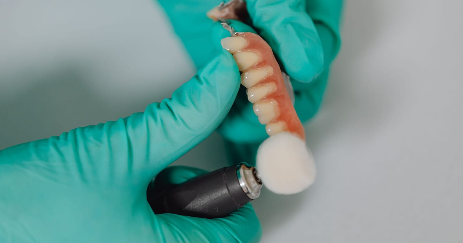 Dental Bridges vs Dental Implants: Which Is Right for You?