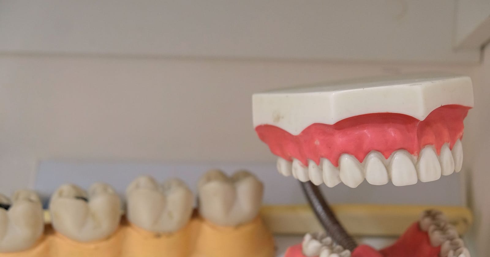 Dental Implants & Affordable Dentures | Laguna Surgical