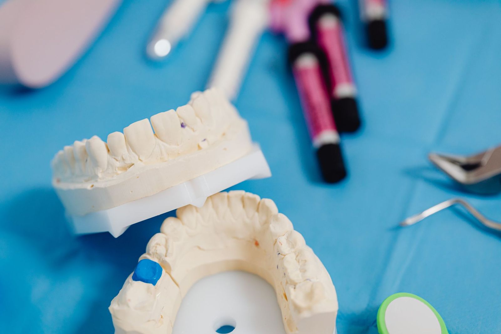 Modelos dentales de arcada completa usados para planear implantes de boca completa