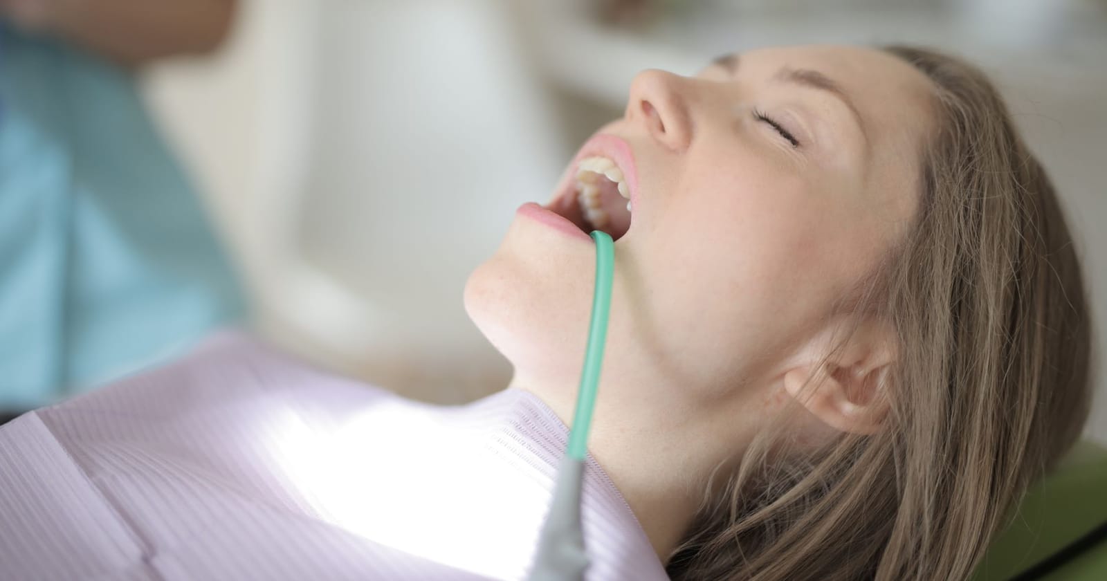 Full Mouth Dental Implants: Complete Patient Guide