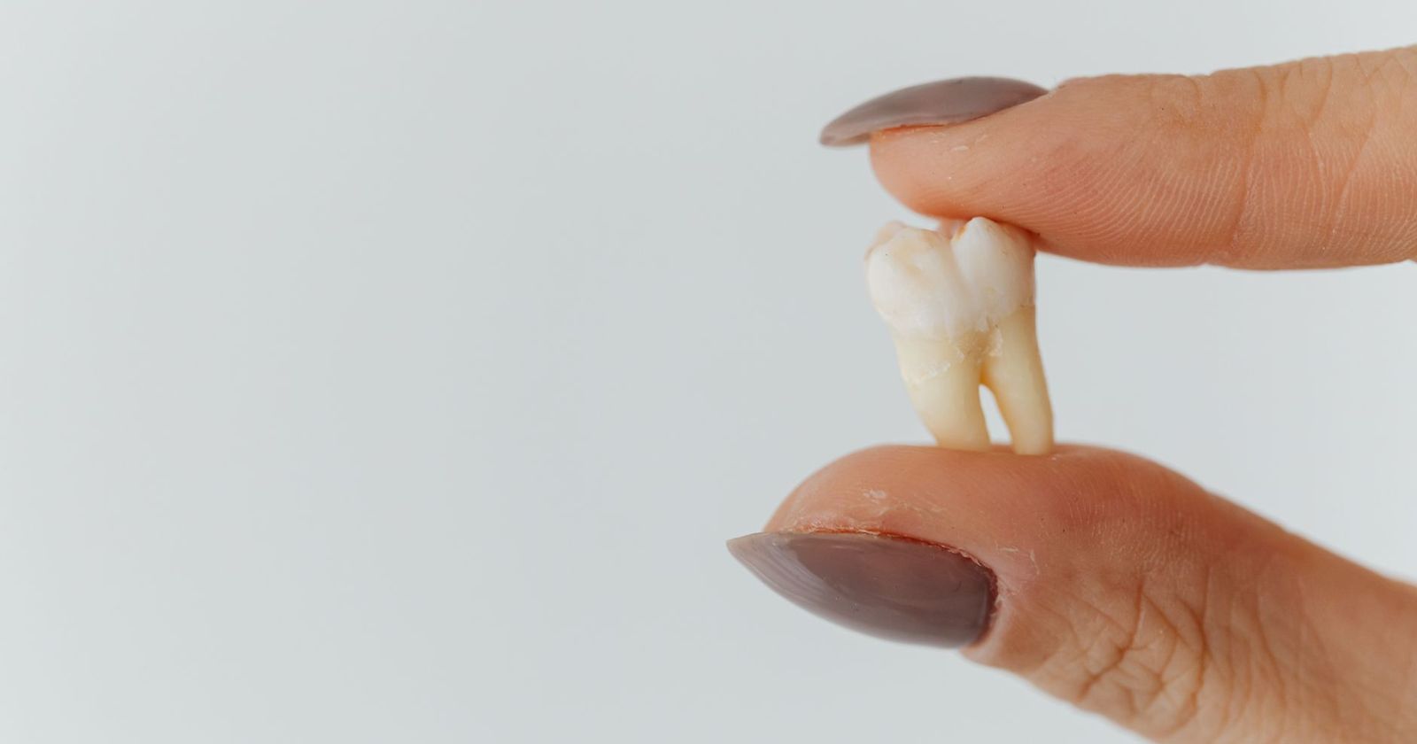 Is a Teeth Transplant Real? What People Mean by Tooth Transplant
