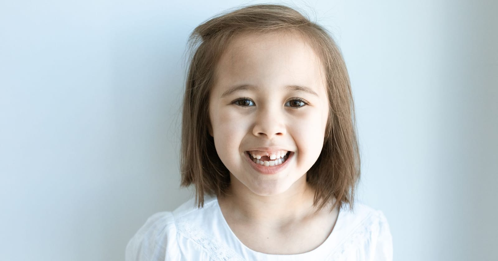 Tooth Bridge Cost: Pricing, Options & What to Expect